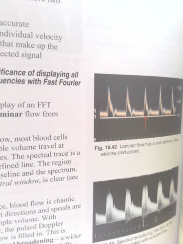 Actual Product Display 4